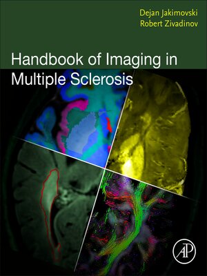 cover image of Handbook of Imaging in Multiple Sclerosis